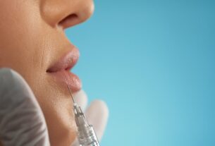 Técnica Safe Lips reduz riscos no preenchimento labial