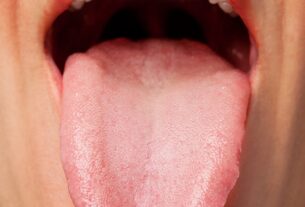 Falta de cuidados com a língua pode impactar a saúde