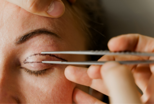 Blefaroplastia: procedimento que rejuvenesce o olhar