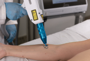 Procura por remoção de tatuagens cresce no Brasil