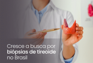Cresce a busca por biópsias de tireoide no Brasil