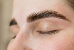FUE Long Hair dá naturalidade ao transplante de sobrancelhas