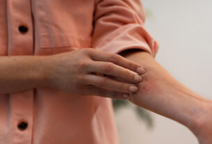 Diagnóstico tardio agrava casos de hidradenite no país