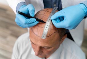 Clínica Artisti oferece tratamentos capilares personalizados